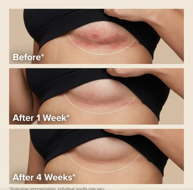 go me.™ | Intertrigo Relief Cream
